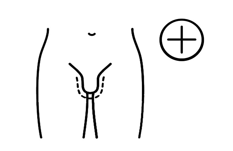Penile Enlargement