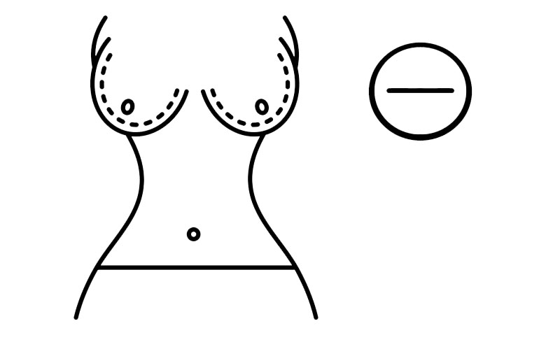 Breast Reduction