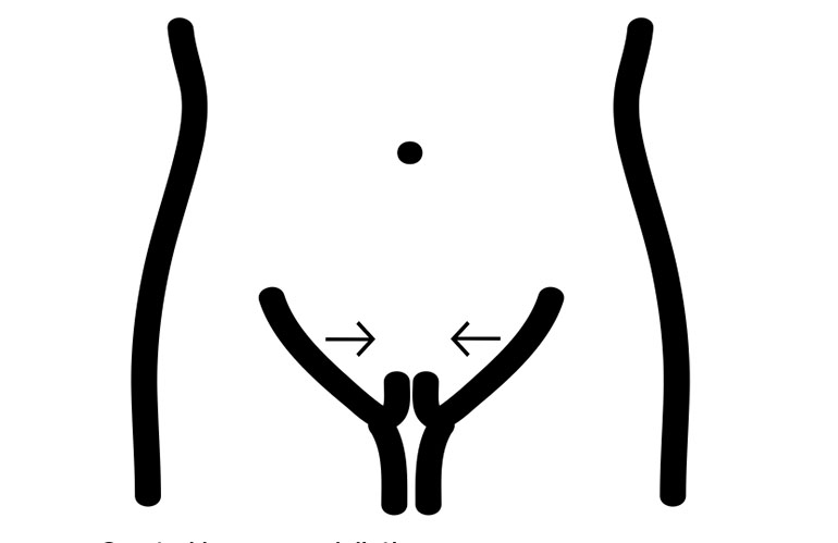 Vaginoplasty