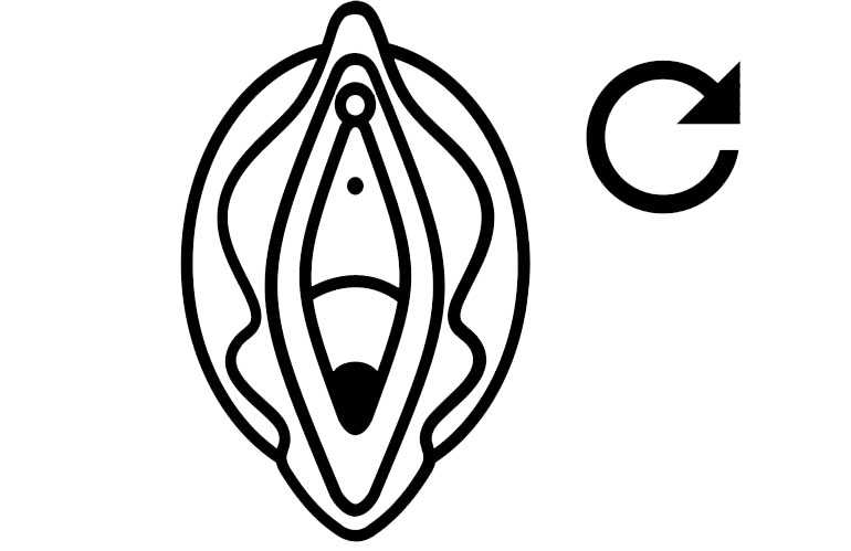 Labiaplasty