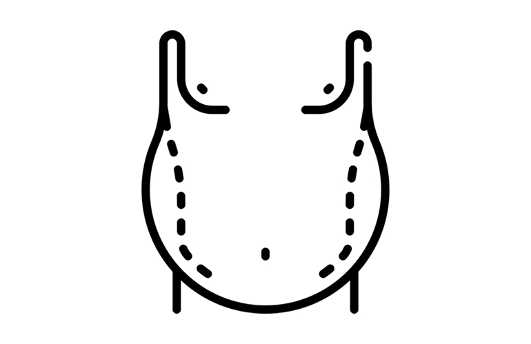 Tummy Liposuction